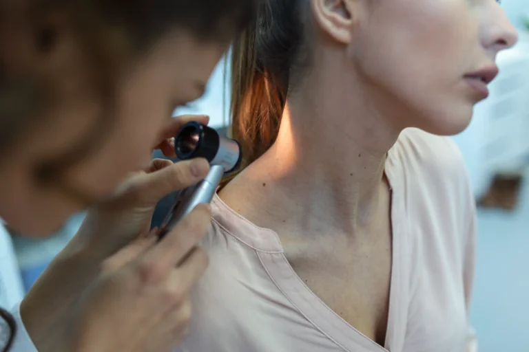 Warts OTC Treatment: Best Options & Safety Guide (2026)
